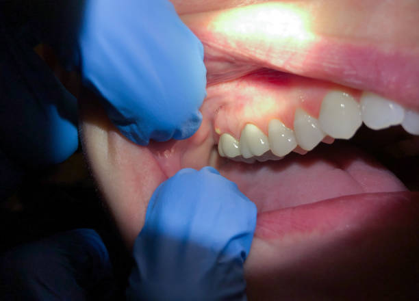 Best Emergency Orthodontic Repairs in Blacklick Estates, OH