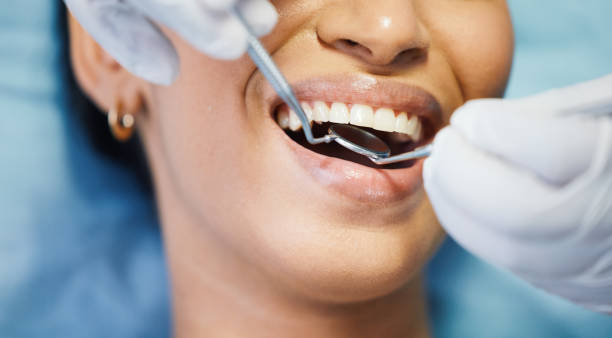 Best Emergency Broken Tooth Repair in Blacklick Estates, OH
